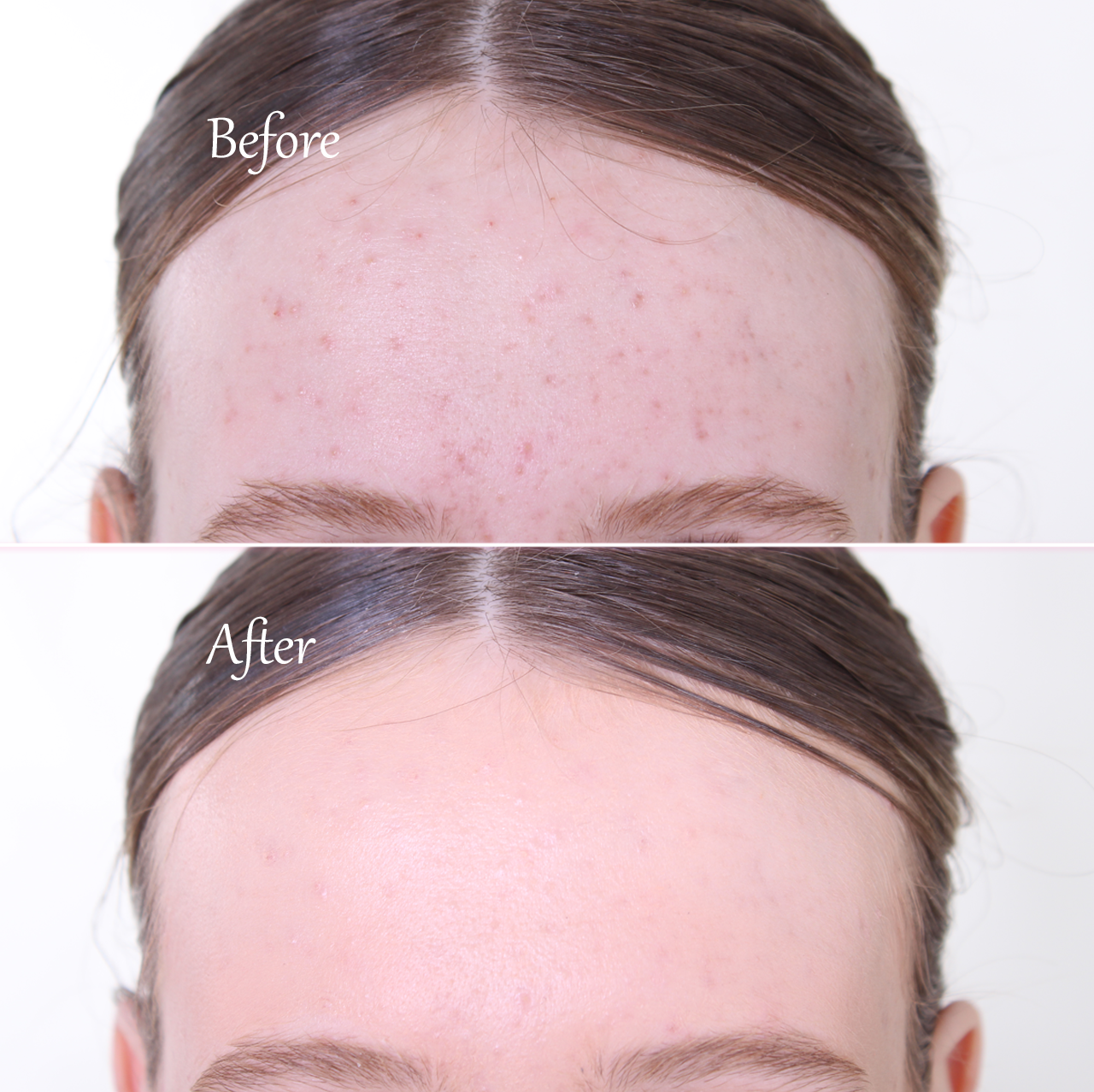 COMPLETE MEANT TO B KIT